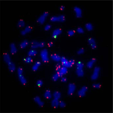 Image of chromosomes with telomeres highlighted.